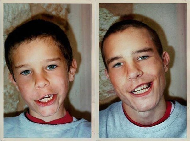 Идея для фото: было и стало