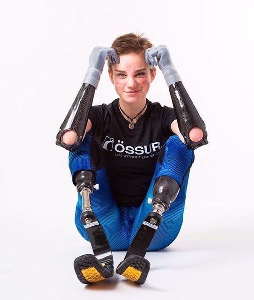 Беатрис Вио – жертва менингита и чемпионка мира по паралимпийскому фехтованию